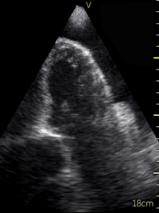 Vol 01 Iss 03 - OCT 2016 Archives - POCUS Journal