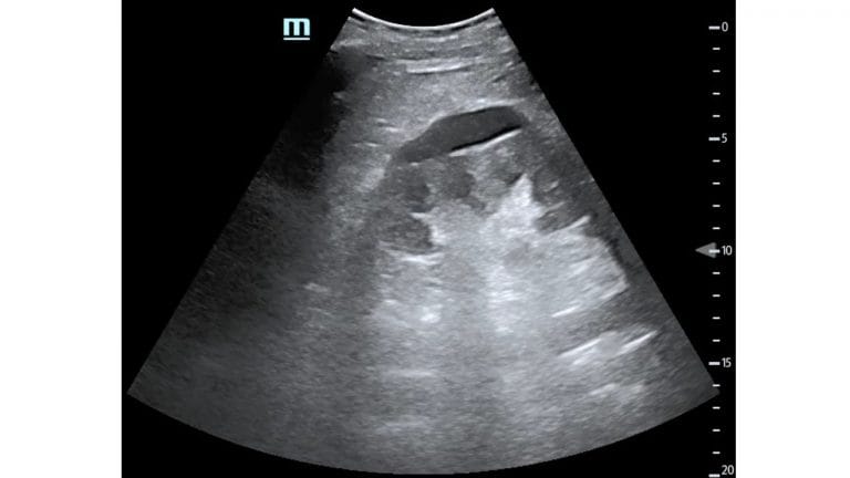 Vol 05 Iss 02 - NOV 2020 Archives - POCUS Journal