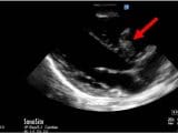 Current Issue – POCUS Journal