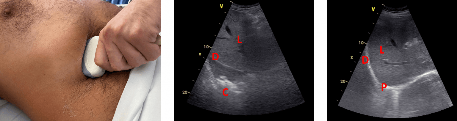 Vol 06 Iss 01 - APR 2021 Archives - POCUS Journal