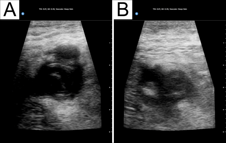 Vol 06 Iss 02 - NOV 2021 Archives - POCUS Journal
