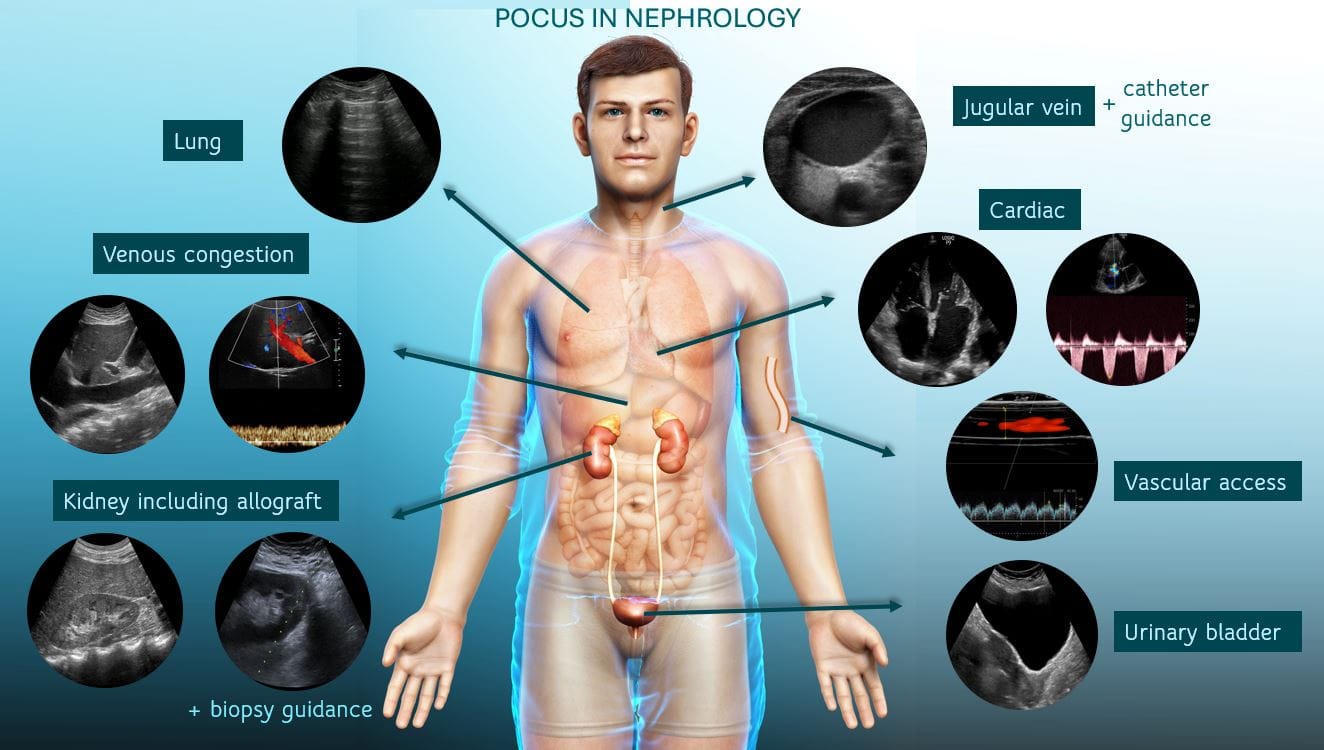About the Special Kidney Issue - POCUS Journal