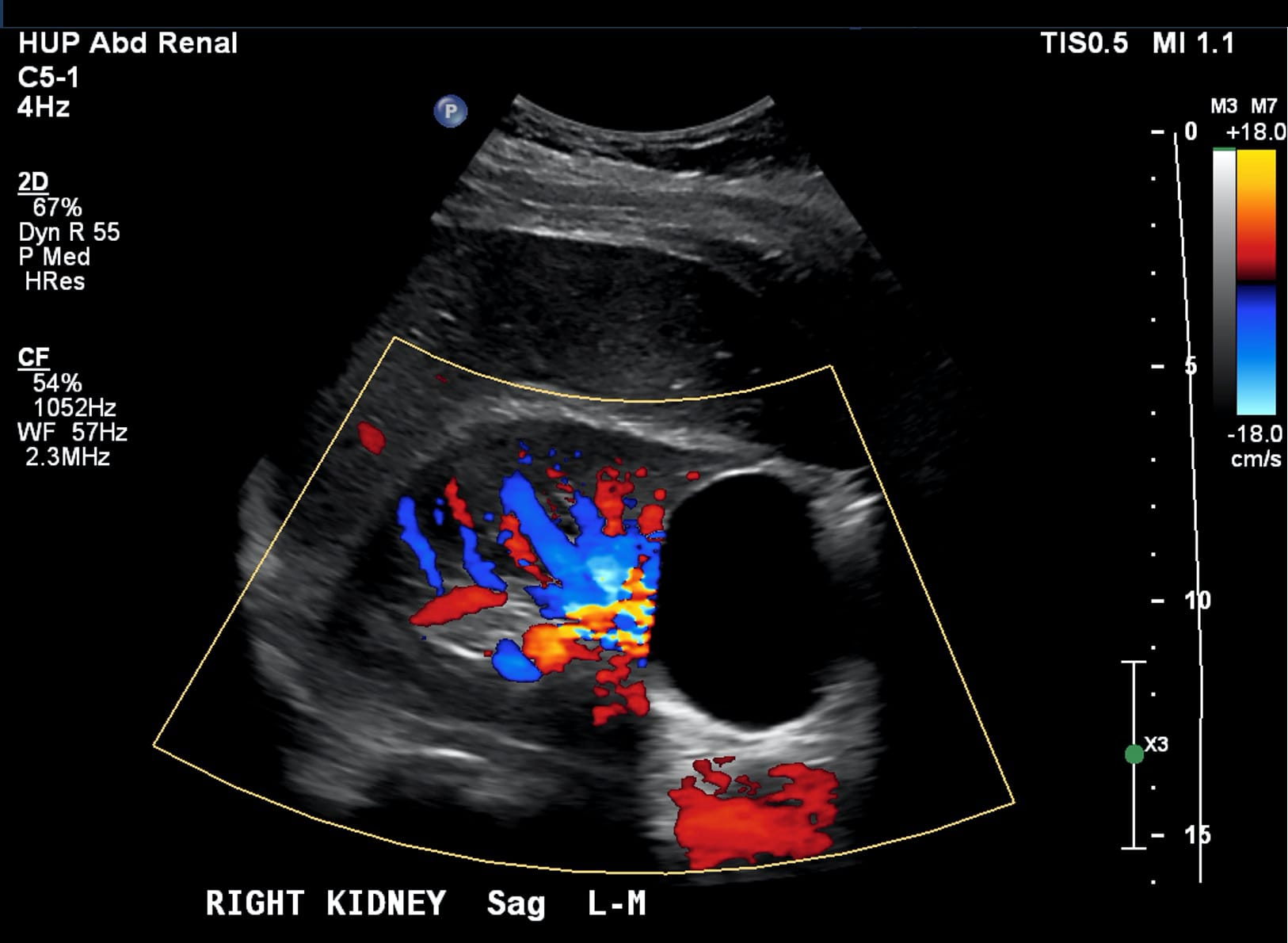ATLAS OF Renal Ultrasonography O'NEILL 【公式通販】