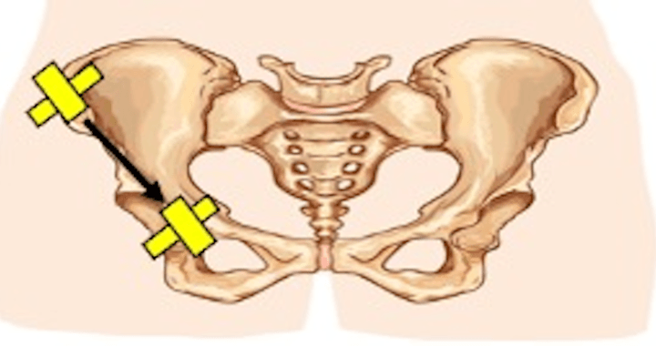 pelvic fracture Archives - POCUS Journal