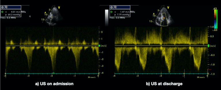 Vol 07 Iss 01 - APR 2022 Archives - POCUS Journal