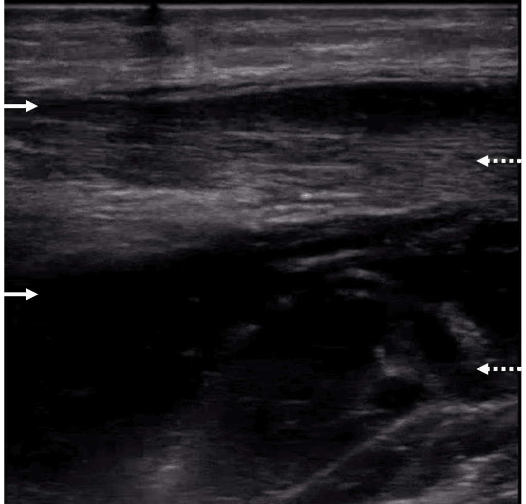 Vol 09 Iss 02 – NOV 2024 Archives - POCUS Journal