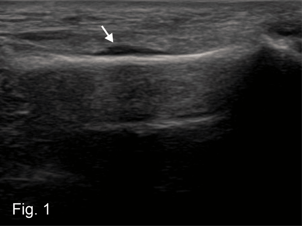 Vol 09 Iss 02 – NOV 2024 Archives - POCUS Journal
